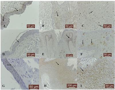 Expression of collagenases (matrix metalloproteinase-1, -8, -13) and tissue inhibitor of metalloproteinase-3 (TIMP-3) in naturally occurring bovine cutaneous fibropapillomas